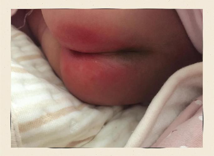 新生儿放屁时脸憋通红是正常现象吗？需要担心吗？-第1张图片-郑州医学网