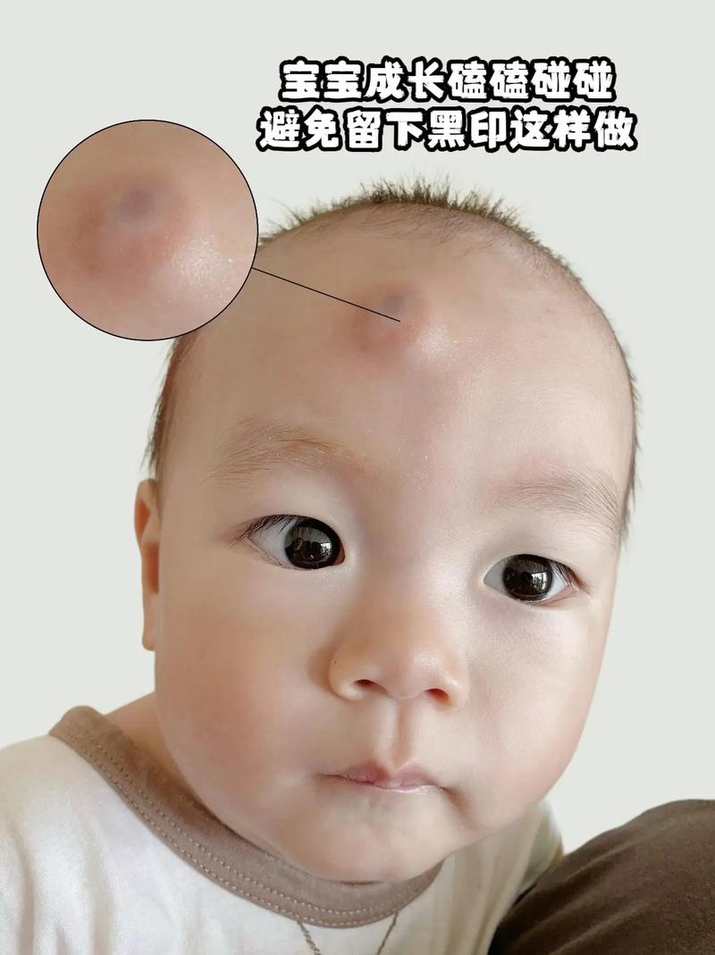 新生儿心律失常有哪些典型症状？家长该如何早期识别与应对？-第3张图片-郑州医学网