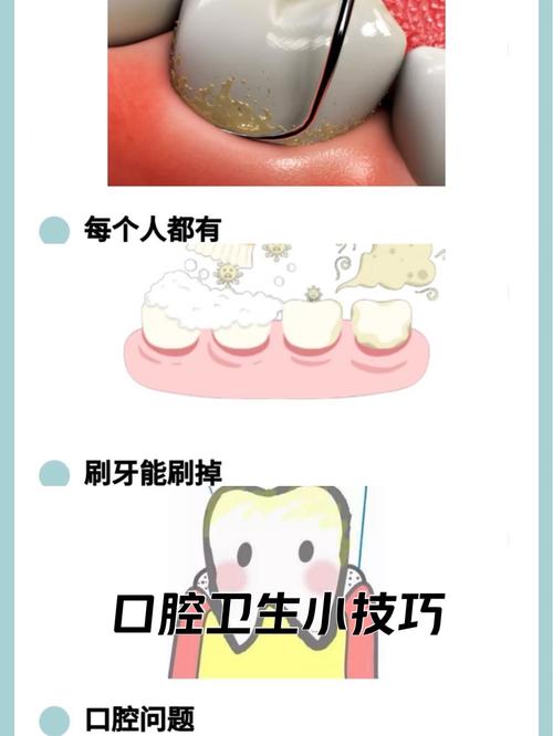 儿童牙齿长出难看黄斑，到底用什么方法才能彻底去除？-第3张图片-郑州医学网