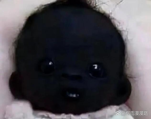 新生儿肤色突然变深是正常现象吗？需警惕哪些健康问题？-第1张图片-郑州医学网