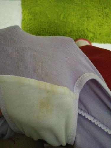 孕期内裤湿一小块是正常分泌物还是异常漏羊水？附图片如何判断？-第2张图片-郑州医学网