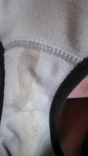 孕期内裤湿一小块是正常分泌物还是异常漏羊水？附图片如何判断？-第3张图片-郑州医学网