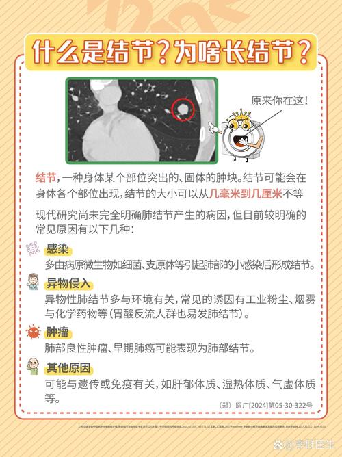 儿童肺结节是怎么回事？需警惕哪些潜在风险与应对策略？-第1张图片-郑州医学网