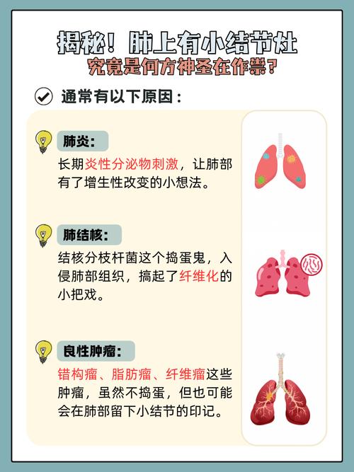 儿童肺结节是怎么回事？需警惕哪些潜在风险与应对策略？-第2张图片-郑州医学网