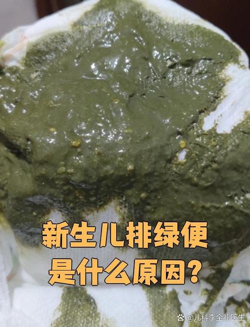 新生儿便便发绿带粘液是消化不良还是感染信号？-第3张图片-郑州医学网