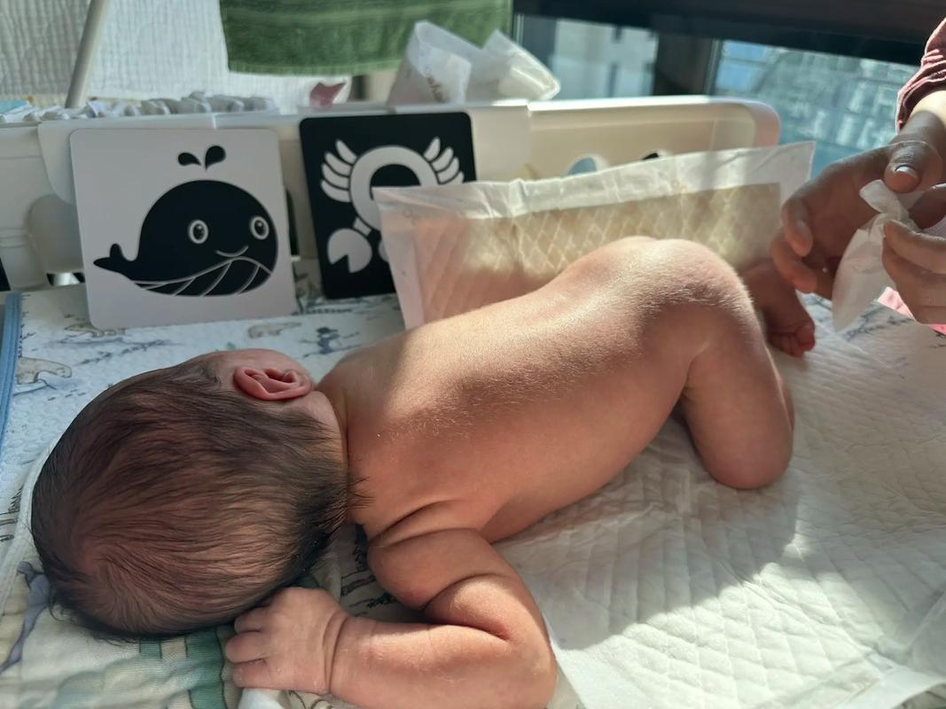 新生儿后背黑毛是正常现象吗？需要担心健康问题吗？-第3张图片-郑州医学网