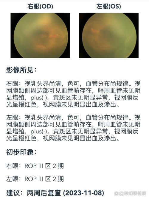 新生儿眼底检查费用受哪些因素影响，大概需要多少钱？-第1张图片-郑州医学网