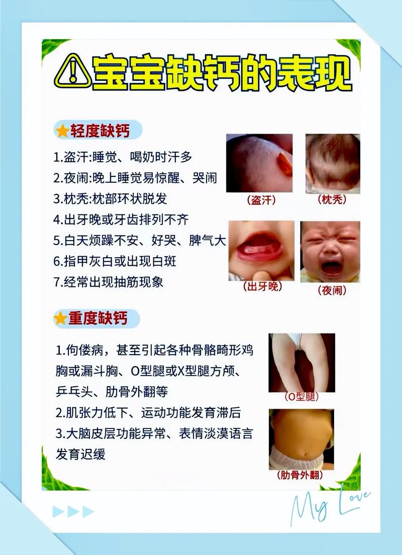 新生儿怎么查缺不缺钙？需要做哪些检查？结果怎么看？-第1张图片-郑州医学网