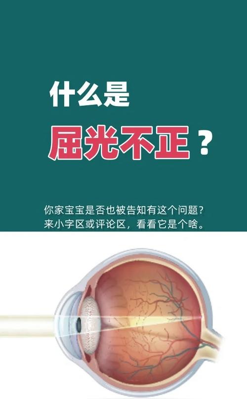 儿童屈光度是什么？它与视力发育、近视防控有何关联？-第2张图片-郑州医学网