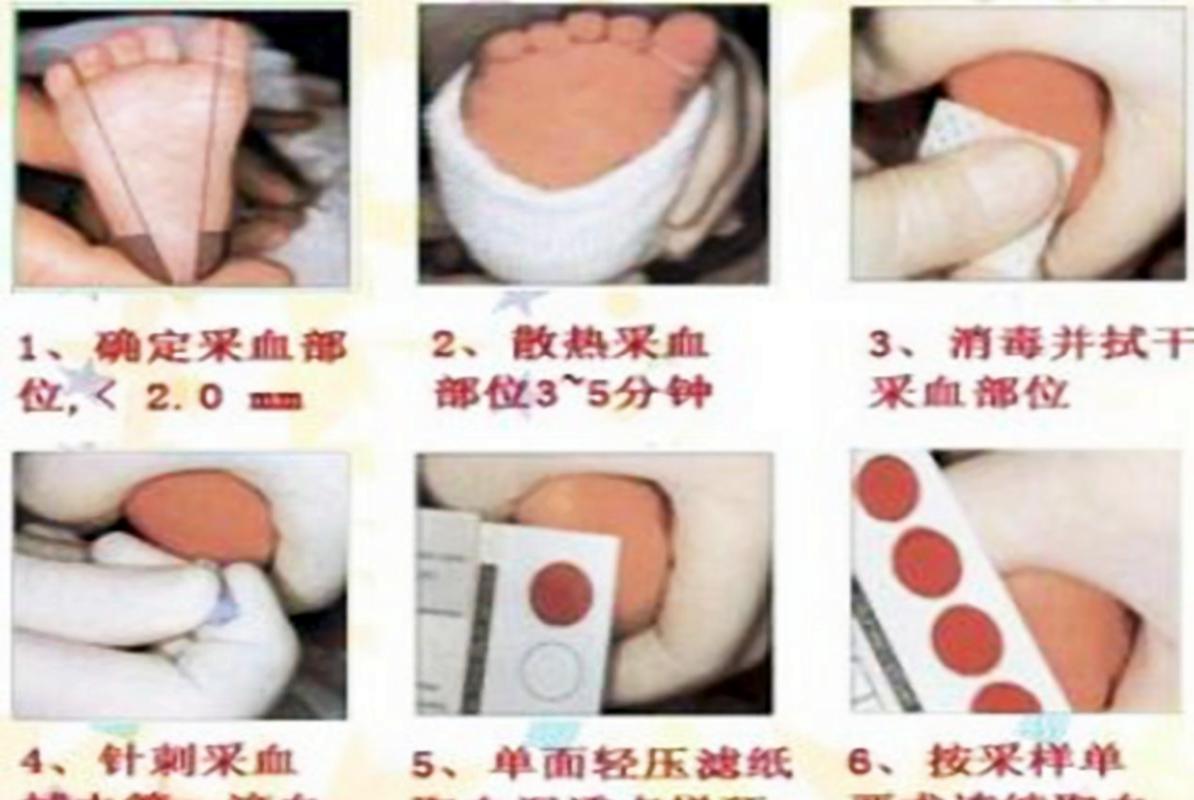 新生儿足跟血检测真的必须做吗？不做会有哪些健康风险或潜在问题？-第1张图片-郑州医学网
