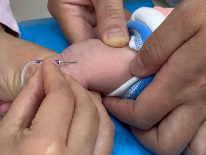 新生儿足跟血检测真的必须做吗？不做会有哪些健康风险或潜在问题？-第3张图片-郑州医学网