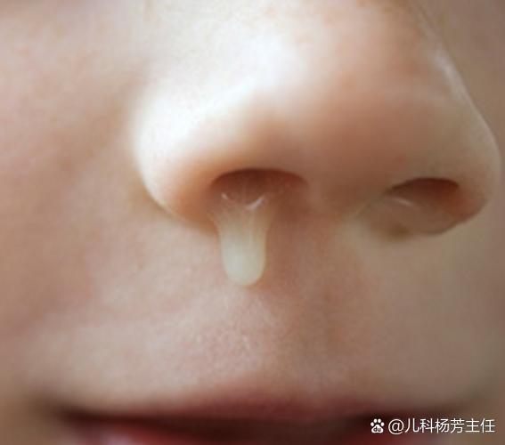 新生儿频繁打喷嚏伴流黄鼻涕，是感冒还是鼻腔发育问题？-第2张图片-郑州医学网