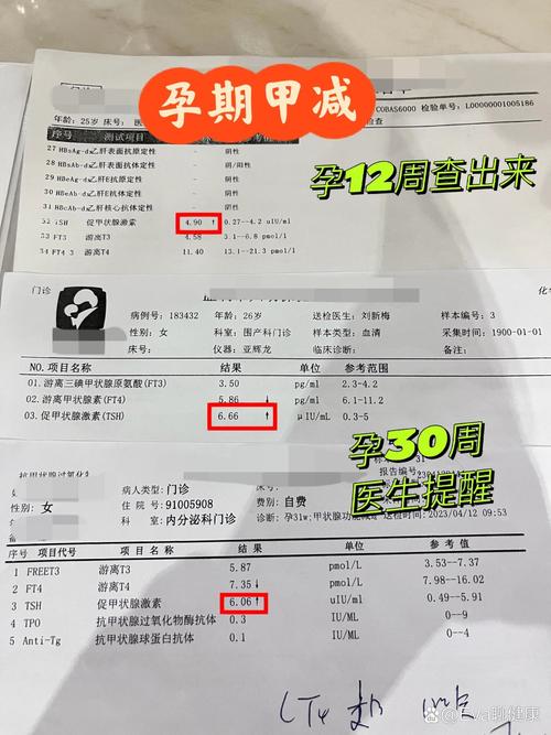 怀孕期间甲减会怎么样-第1张图片-郑州医学网