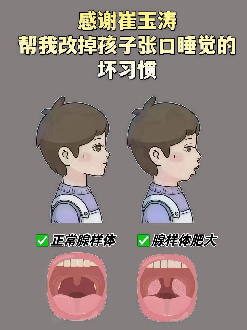 新生儿右腮比左腮大，是生理性不对称还是需要干预？如何科学纠正？-第2张图片-郑州医学网