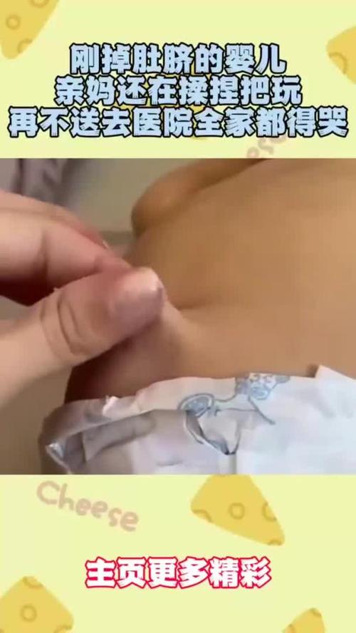 新生儿脐带不小心扯掉后会不会感染？正确处理方法是什么？-第3张图片-郑州医学网