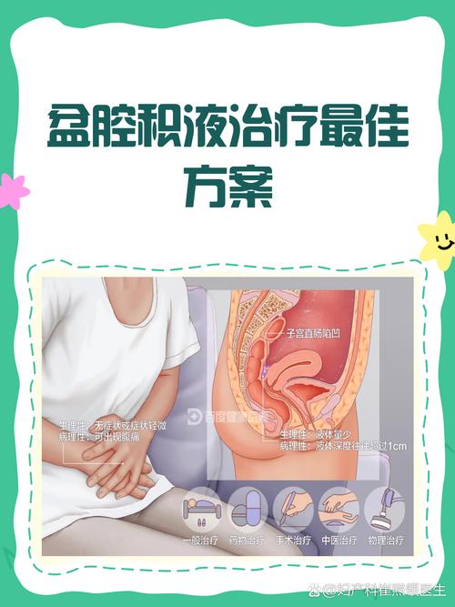孩子查出盆腔积液家长该怎么办？是否需要治疗？一文读懂原因与对策-第2张图片-郑州医学网