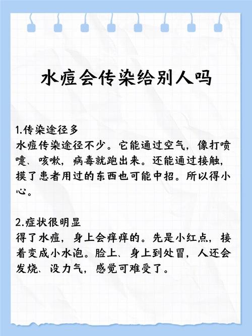 儿童水痘会传染大人吗-第1张图片-郑州医学网