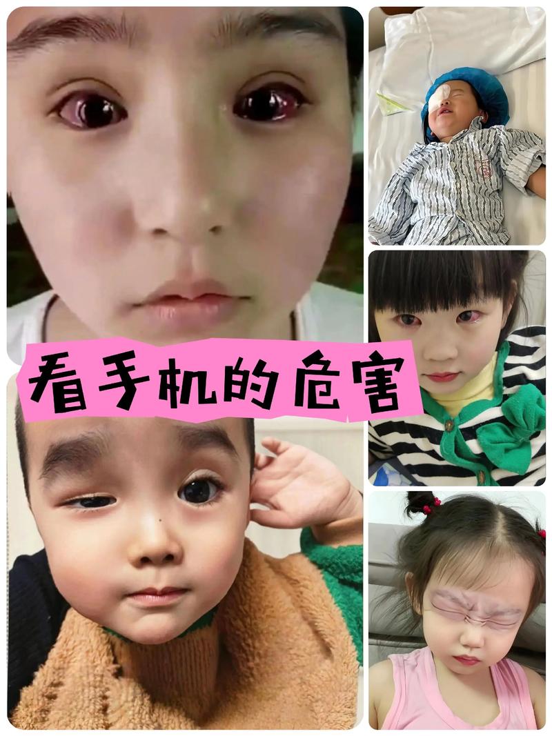 儿童沉迷玩手机游戏，视力、心理与社交能力该如何守护？-第2张图片-郑州医学网