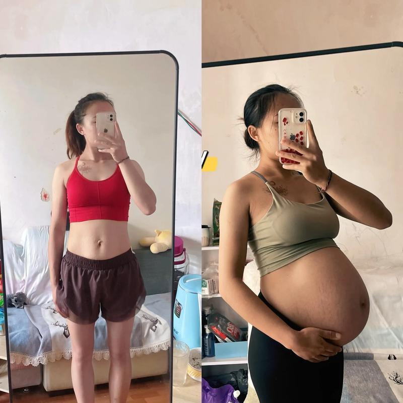 孕期肚子左右不对称正常吗？是否需要担心胎儿发育问题？-第1张图片-郑州医学网