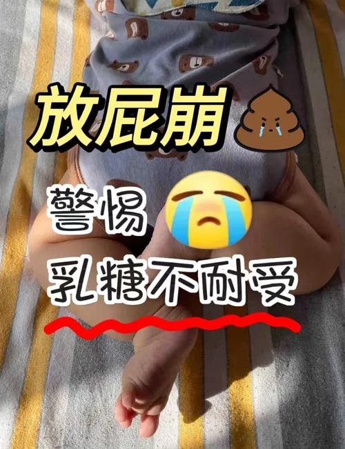 新生儿老放臭屁不大便-第2张图片-郑州医学网