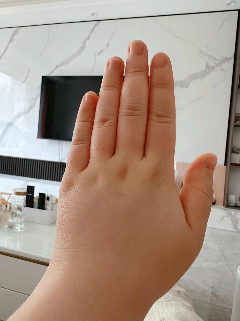 孕期5个月脚肿是正常现象吗？需要警惕哪些异常情况？-第2张图片-郑州医学网