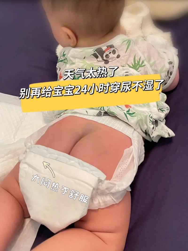 新生儿10小时无尿是正常现象还是健康预警？需紧急就医吗？-第1张图片-郑州医学网