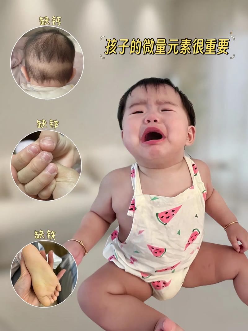 新生儿出现黄头发是营养不良还是正常生理现象？-第2张图片-郑州医学网