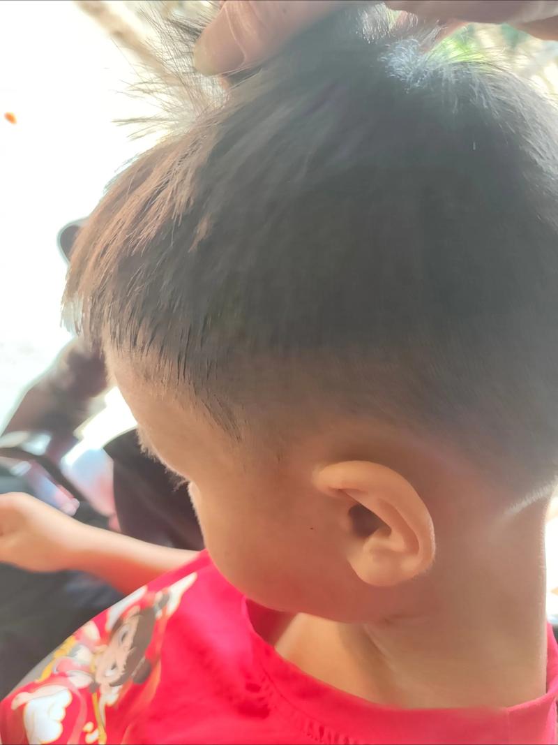 新生儿出现黄头发是营养不良还是正常生理现象？-第3张图片-郑州医学网