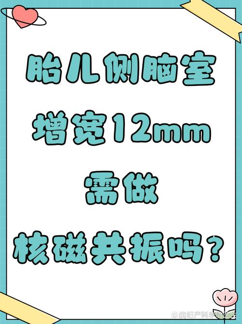 新生儿脑室增宽常见吗？会对宝宝发育有影响吗？需要治疗吗？-第3张图片-郑州医学网