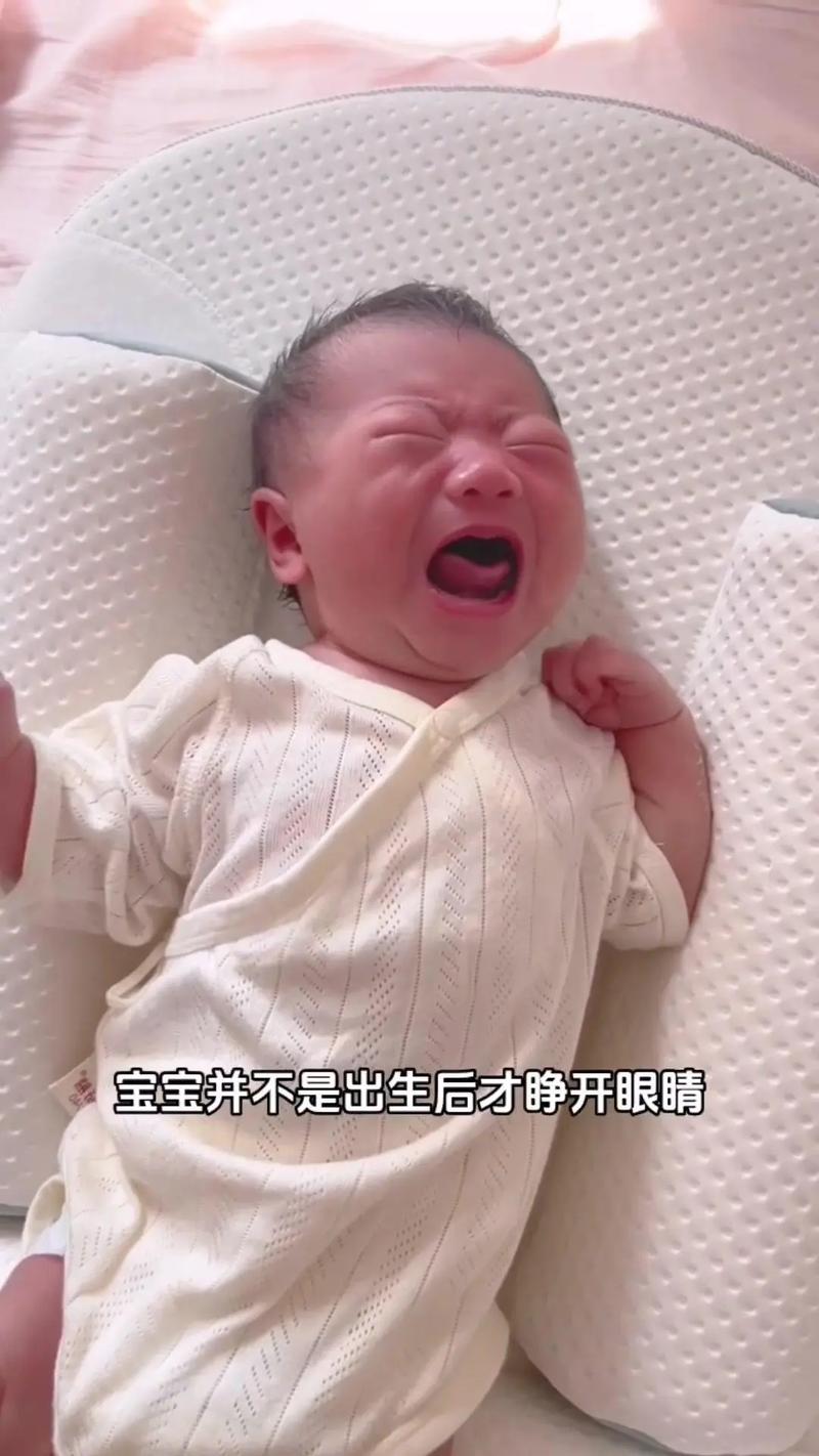 新生儿眼睛好厚却不睁开，是正常发育还是异常信号？-第2张图片-郑州医学网