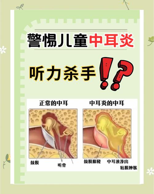 新生儿听力筛查未通过，究竟是什么原因导致的呢？-第3张图片-郑州医学网