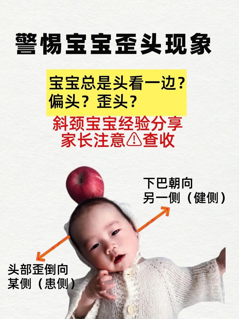 新生儿头总是转来转去是正常发育表现还是需要关注的异常信号？-第2张图片-郑州医学网