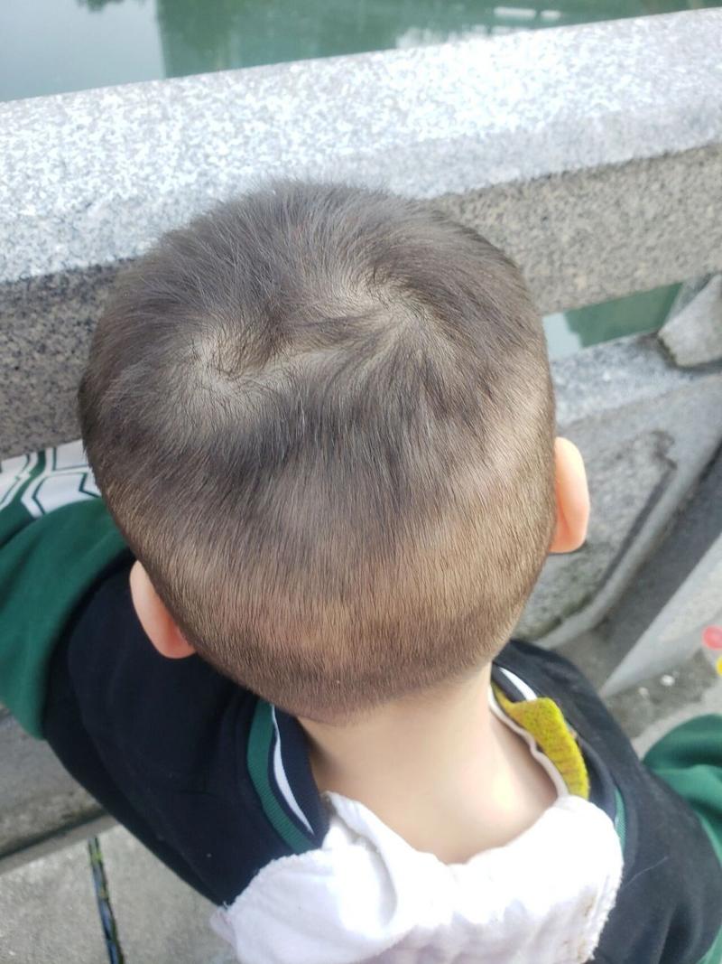 新生儿头总是转来转去是正常发育表现还是需要关注的异常信号？-第1张图片-郑州医学网