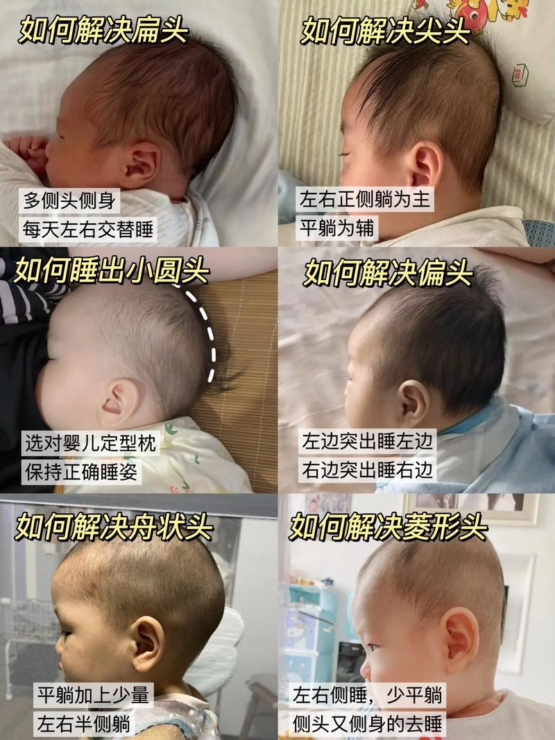 新生儿究竟要多大才能用定型枕？过早使用会影响发育吗？-第2张图片-郑州医学网