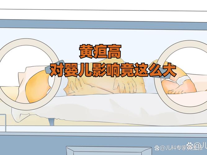 新生儿母乳黄疸眼白黄-第2张图片-郑州医学网
