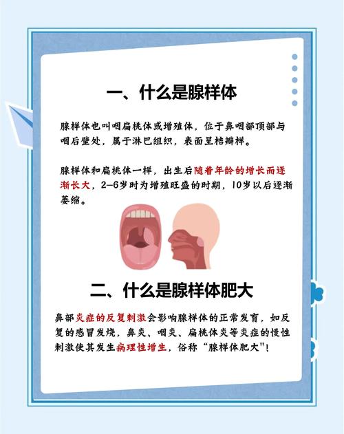 儿童腺样体肥大怎么治-第1张图片-郑州医学网