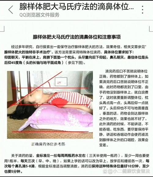 儿童腺样体肥大怎么治-第2张图片-郑州医学网