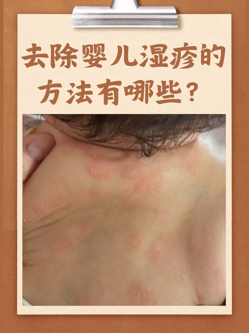 儿童身上反复发痒，是过敏、寄生虫还是其他健康问题？-第1张图片-郑州医学网