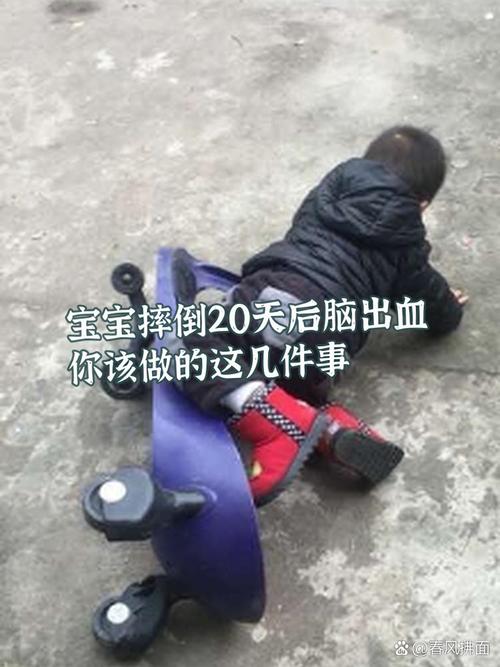 儿童摔到后脑勺后，家长该如何判断伤情及正确处理？-第1张图片-郑州医学网