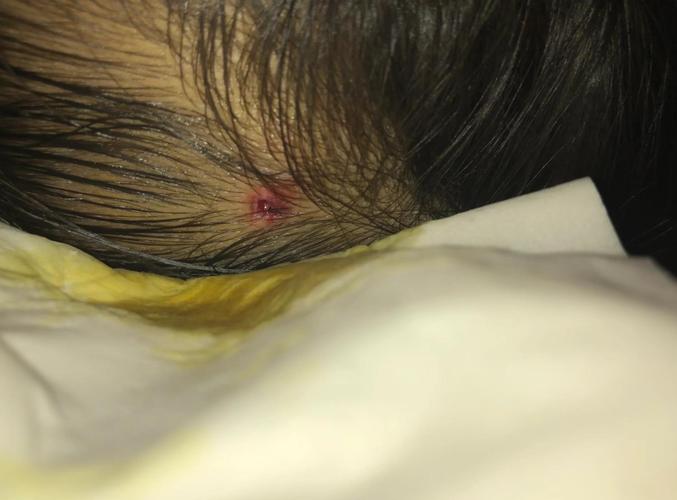 儿童摔到后脑勺后，家长该如何判断伤情及正确处理？-第2张图片-郑州医学网
