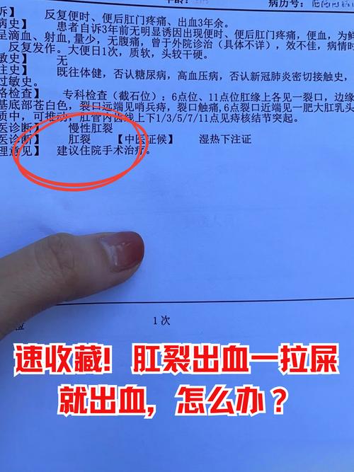 孕期上厕所出血，是先兆流产还是其他问题？该如何紧急处理？-第1张图片-郑州医学网