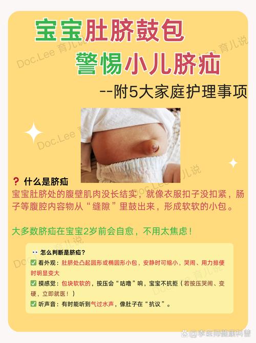 新生儿脐窦会有哪些异常症状？家长该如何早期识别与应对？-第1张图片-郑州医学网