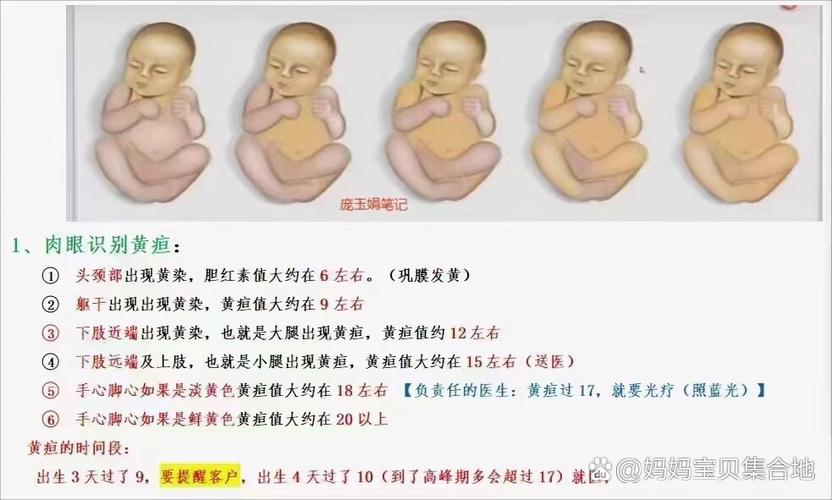 新生儿第6天黄疸指数-第3张图片-郑州医学网