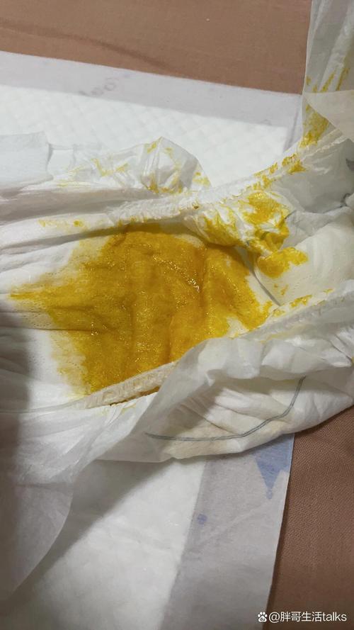 新生儿吃完奶就拉屎是消化不良还是正常生理反应？-第1张图片-郑州医学网