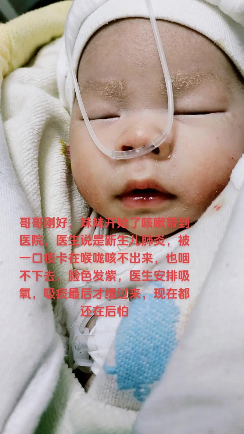 新生儿吸痰有什么危害-第1张图片-郑州医学网