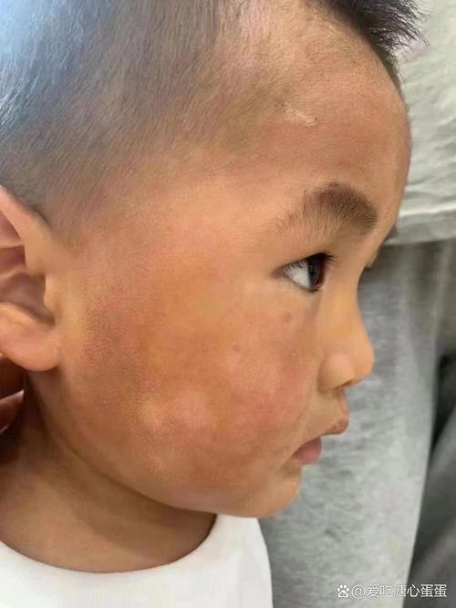 新生儿几个月皮肤会自然变白？影响肤色变化的关键因素有哪些？-第2张图片-郑州医学网