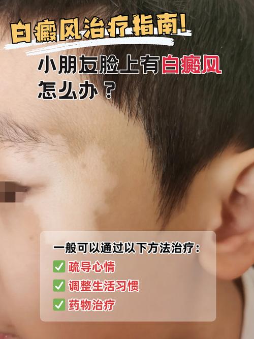 新生儿几个月皮肤会自然变白？影响肤色变化的关键因素有哪些？-第3张图片-郑州医学网