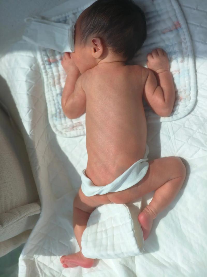 新生儿黄胆怎么晒太阳-第2张图片-郑州医学网