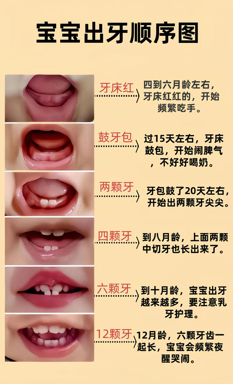 新生儿长牙齿是异常现象吗？需要担心健康问题吗？-第1张图片-郑州医学网