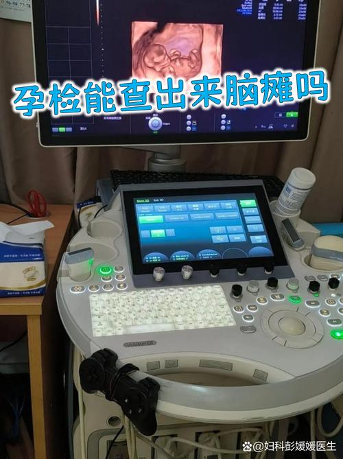 孕期真能提前查出脑瘫儿吗？有哪些科学检测手段？-第1张图片-郑州医学网